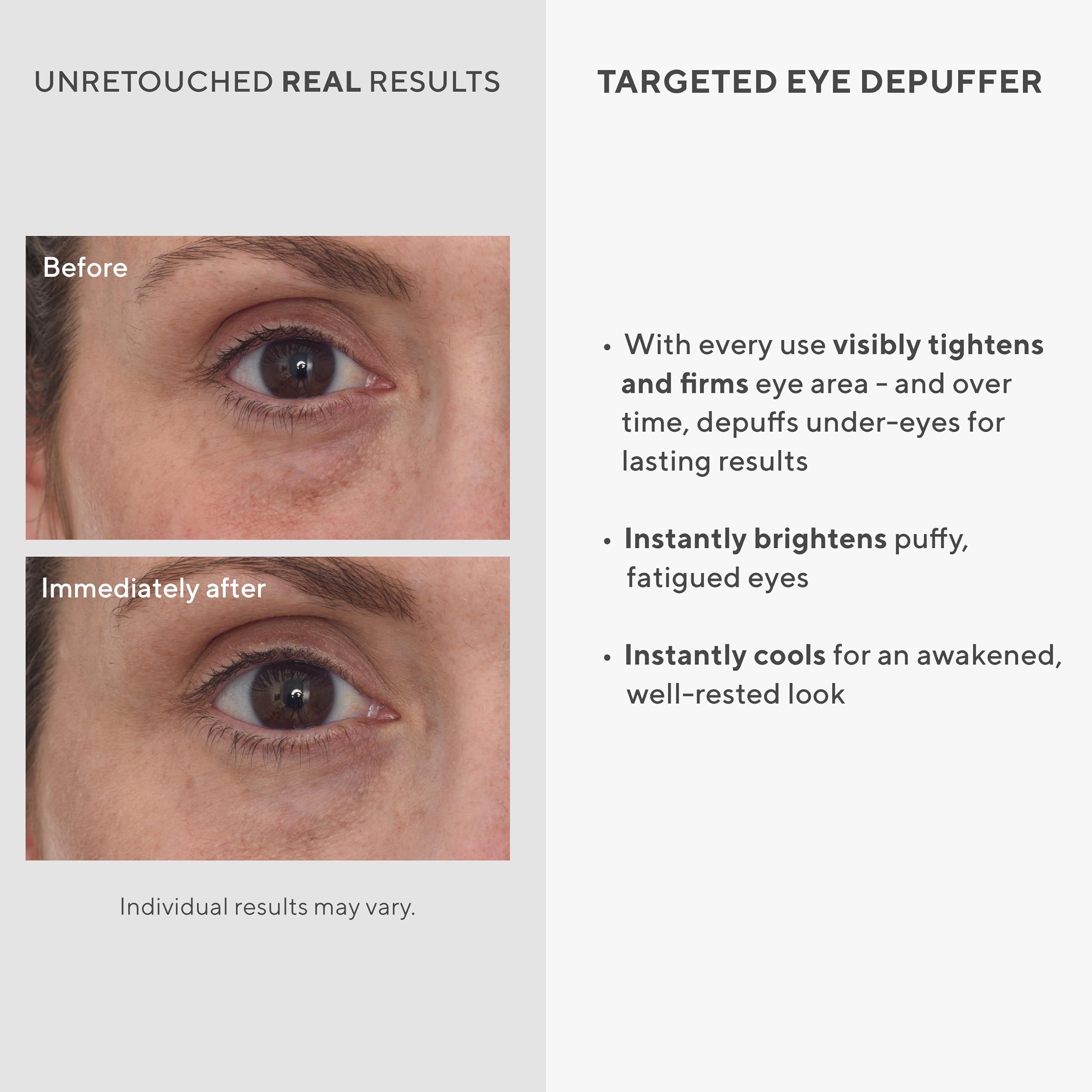 Murad Targeted Eye Depuffer - Visibly Brightens, Depuffs, and Firms Under-Eyes - Anti-Aging Eye Cream - Ginseng, Lily, and Caffeine Massage Away Puffiness and Under-Eye Bags - 0.5 FL OZ